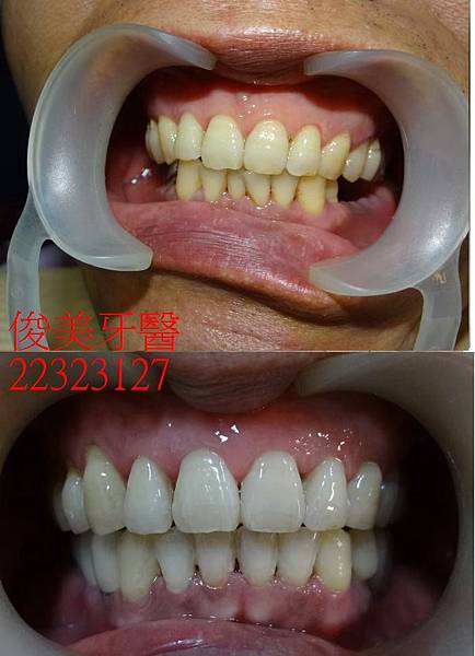 38- (16).JPG 38- (16).JPG