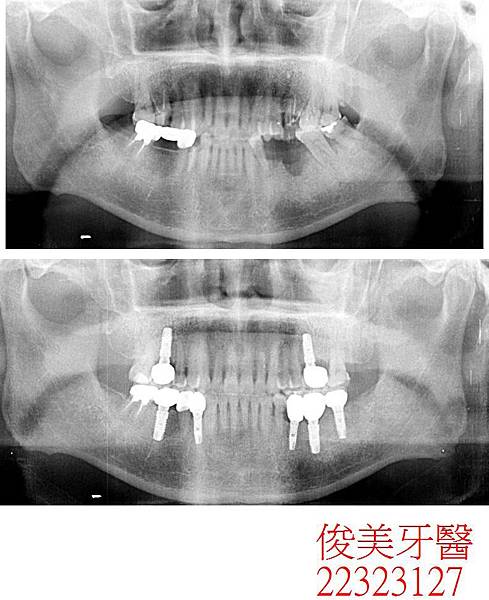 38- (17).JPG 38- (17).JPG