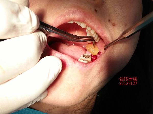 IMG20160920094743君 (8).jpg