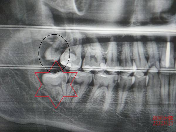 IMG20180423174521中 (4).jpg IMG20180423174521中 (4).jpg