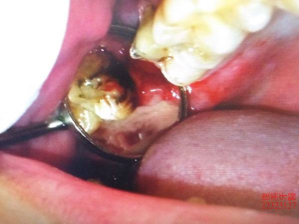 IMG20180423174521中 (6).jpg IMG20180423174521中 (6).jpg