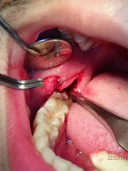 IMG20180423174521中 (1).jpg IMG20180423174521中 (1).jpg