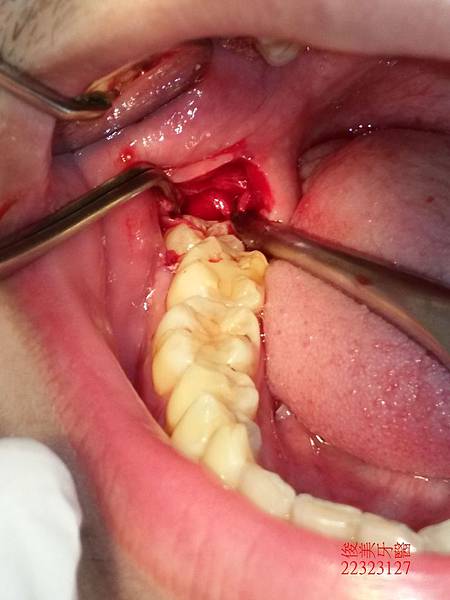 IMG20180423174521中 (3).jpg IMG20180423174521中 (3).jpg