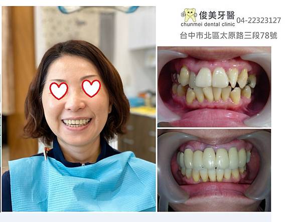 牙齒的治療-有系統性的治療目的、創造美好的治療成果