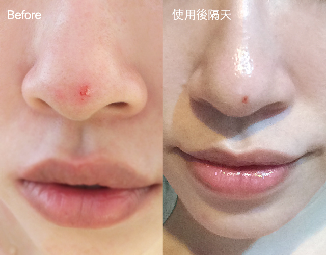 肌膚不留疤痕的萬用神奇霜 理膚寶水全面修復霜 潮流 美妝 消費創造個人化風格的女性社群pixstyleme 肌膚不留疤痕的萬用神奇霜 理膚寶水全面修復霜 潮流 美妝 消費創造個人化風格的女性社群pixstyleme