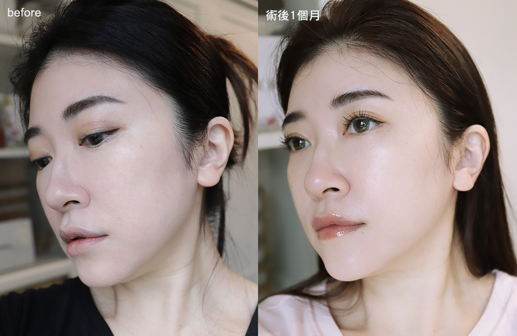 找回消失的輪廓線～Linear Z 音波更快更有感！