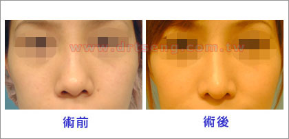 pic-1 (1) pic-1 (1)