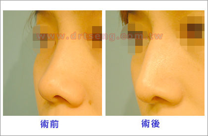 pic-4 (1) pic-4 (1)