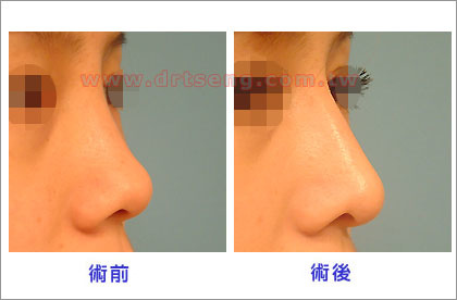 pic-3 (1) pic-3 (1)