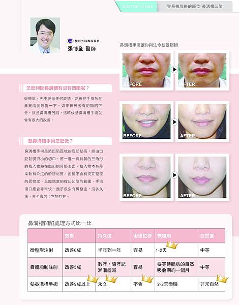 米洛斯_整形達人NO34漫談鼻溝槽手術-2 copy 米洛斯_整形達人NO34漫談鼻溝槽手術-2 copy