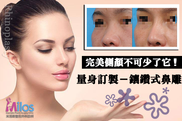 塌鼻樑BYEBYE.jpg 塌鼻樑BYEBYE.jpg