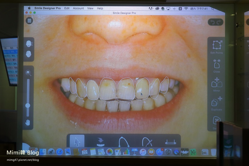 悅庭牙醫-10.jpg 悅庭牙醫-10.jpg