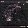 baby-005.jpg