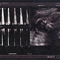 baby-006.jpg