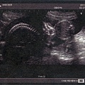 baby-010.jpg