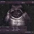 baby-014.jpg