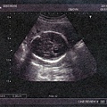 baby-015.jpg