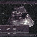 baby-017.jpg