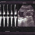 baby-020.jpg