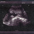 baby-021.jpg