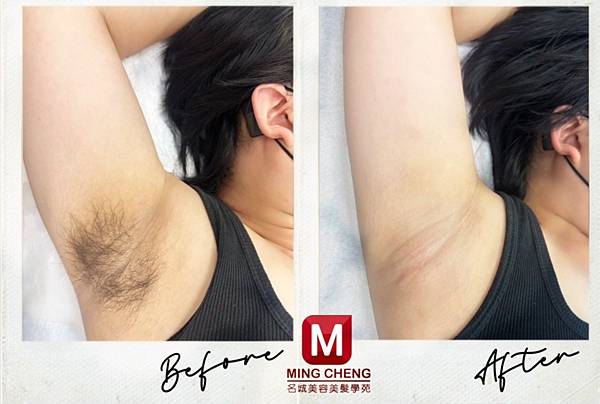 熱蠟除毛創業班 熱蠟除毛創業班