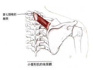 小菱形肌.jpg