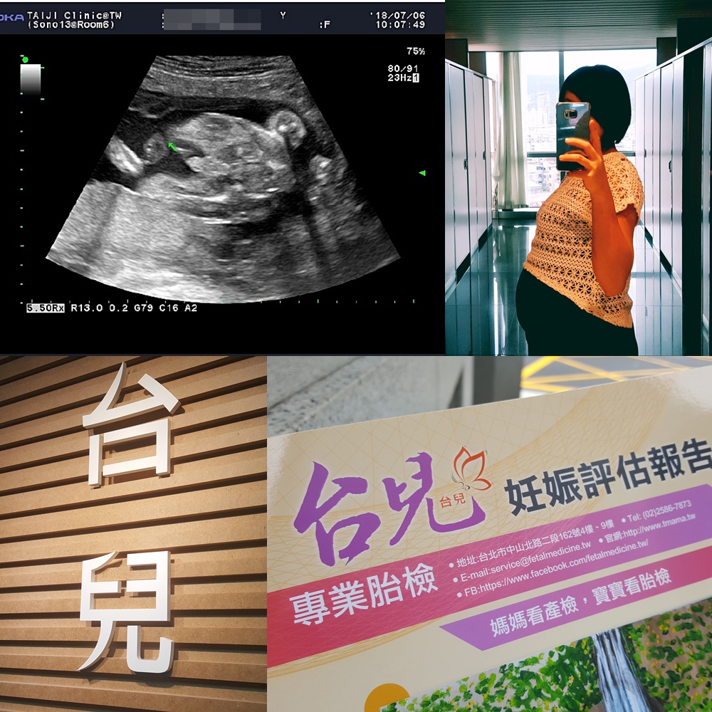 孕二寶 第17週 第22週 性別開獎 台兒診所高層次超音波 媽咪拜mamibuy 孕二寶 第17週 第22週 性別開獎 台兒診所高層次超音波 媽咪拜mamibuy