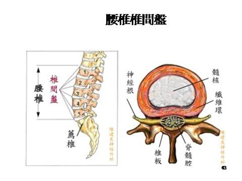 腰椎.jpg 腰椎.jpg