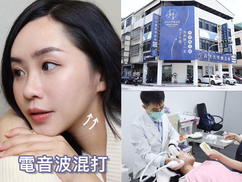 〖醫美〗電音波混打更有感！小資美學診所 Z音波 + 十蓓電波