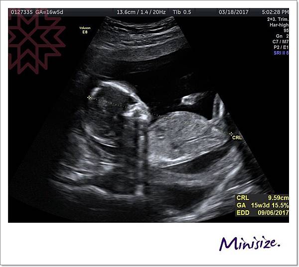 Blog_170321_0012.jpg Blog_170321_0012.jpg