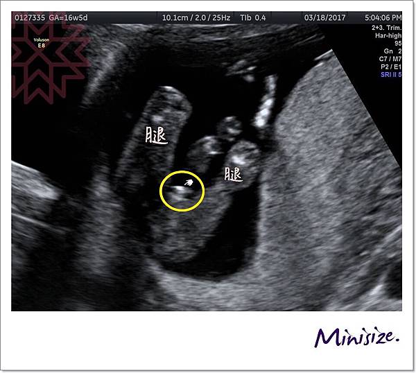 Blog_170321_0016.jpg Blog_170321_0016.jpg