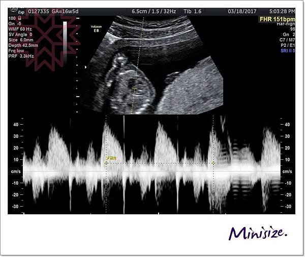 Blog_170322_0019.jpg Blog_170322_0019.jpg