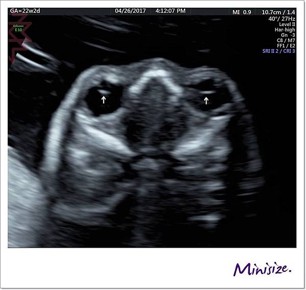 Blog_170427_0089.jpg Blog_170427_0089.jpg