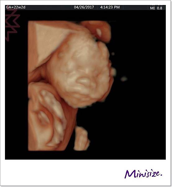 Blog_170427_0092.jpg Blog_170427_0092.jpg