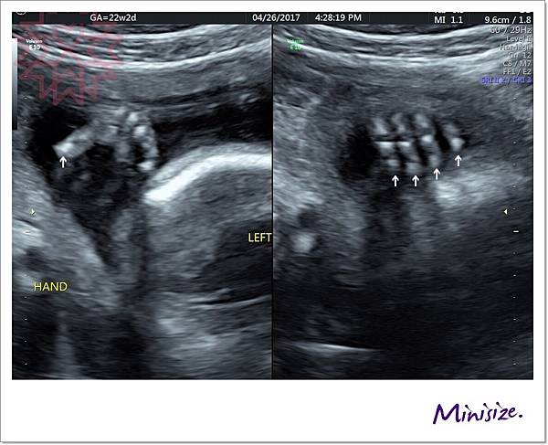 Blog_170429_0096.jpg Blog_170429_0096.jpg