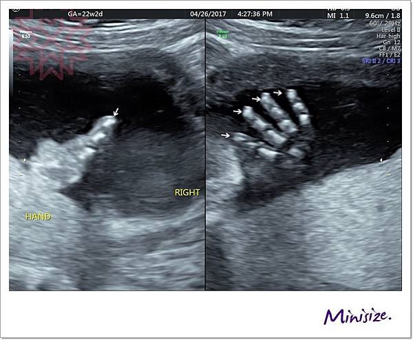 Blog_170429_0095.jpg Blog_170429_0095.jpg