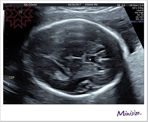 Blog_170429_0097.jpg Blog_170429_0097.jpg