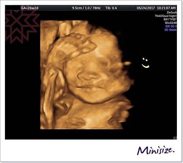 Blog_170530_0146.jpg Blog_170530_0146.jpg