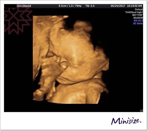 Blog_170530_0148.jpg Blog_170530_0148.jpg