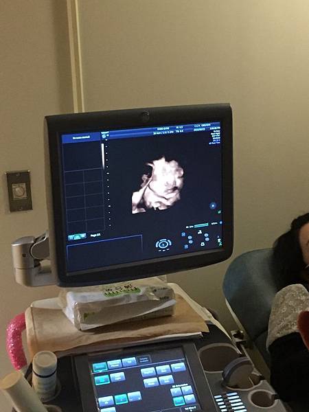 第32周产检心情、开始手麻脚肿啦!|昏贵人妻|妈