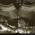 1020510-Little one-252g-18+2w-guess I'm a boy or a girl