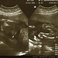 1020607-Little one-250g-18+2w-look at my face