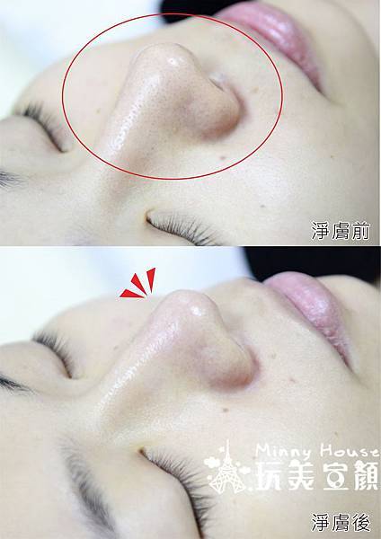 八倍淨膚護理-前後比較.jpg 八倍淨膚護理-前後比較.jpg