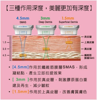 音波拉~1.JPG