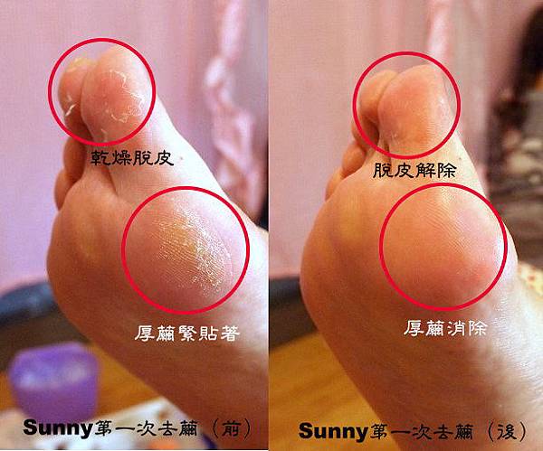 Sunny第一次去繭初體驗