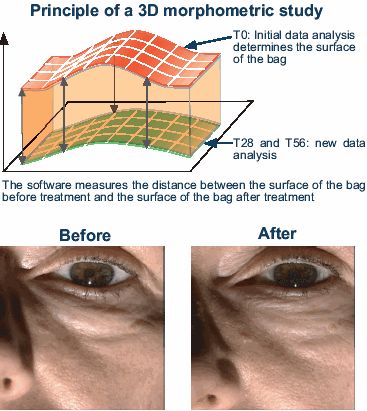 eyeliss-chart.gif