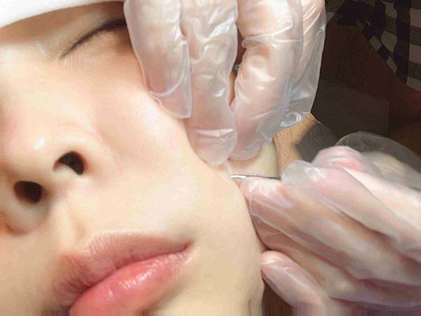 皮膚專家 (57).jpg