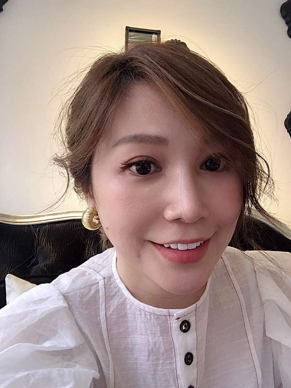 我想好多年又白又整齊的微笑曲線 牙齒貼片心得 李小妹與潔西卡媽媽生活花絮 痞客邦