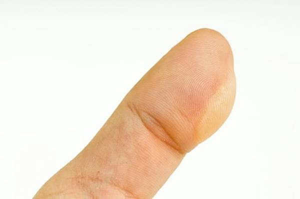 a-blister-on-a-finger.jpg