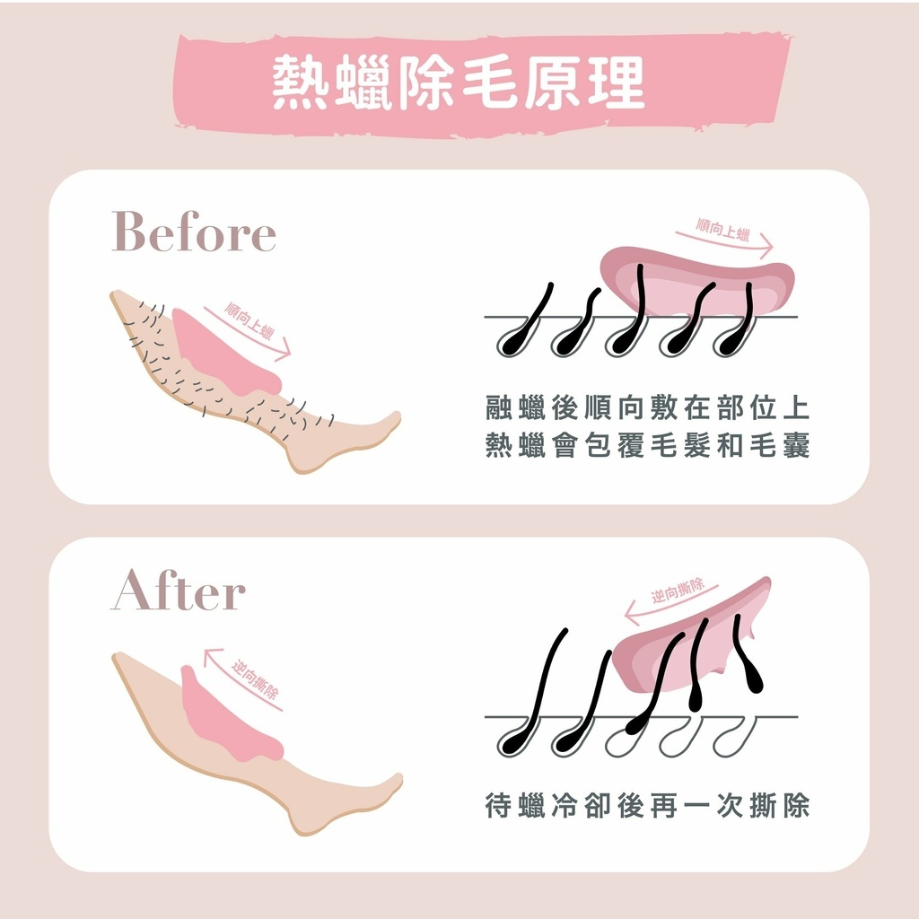 OG_热蜡除毛原理.jpg